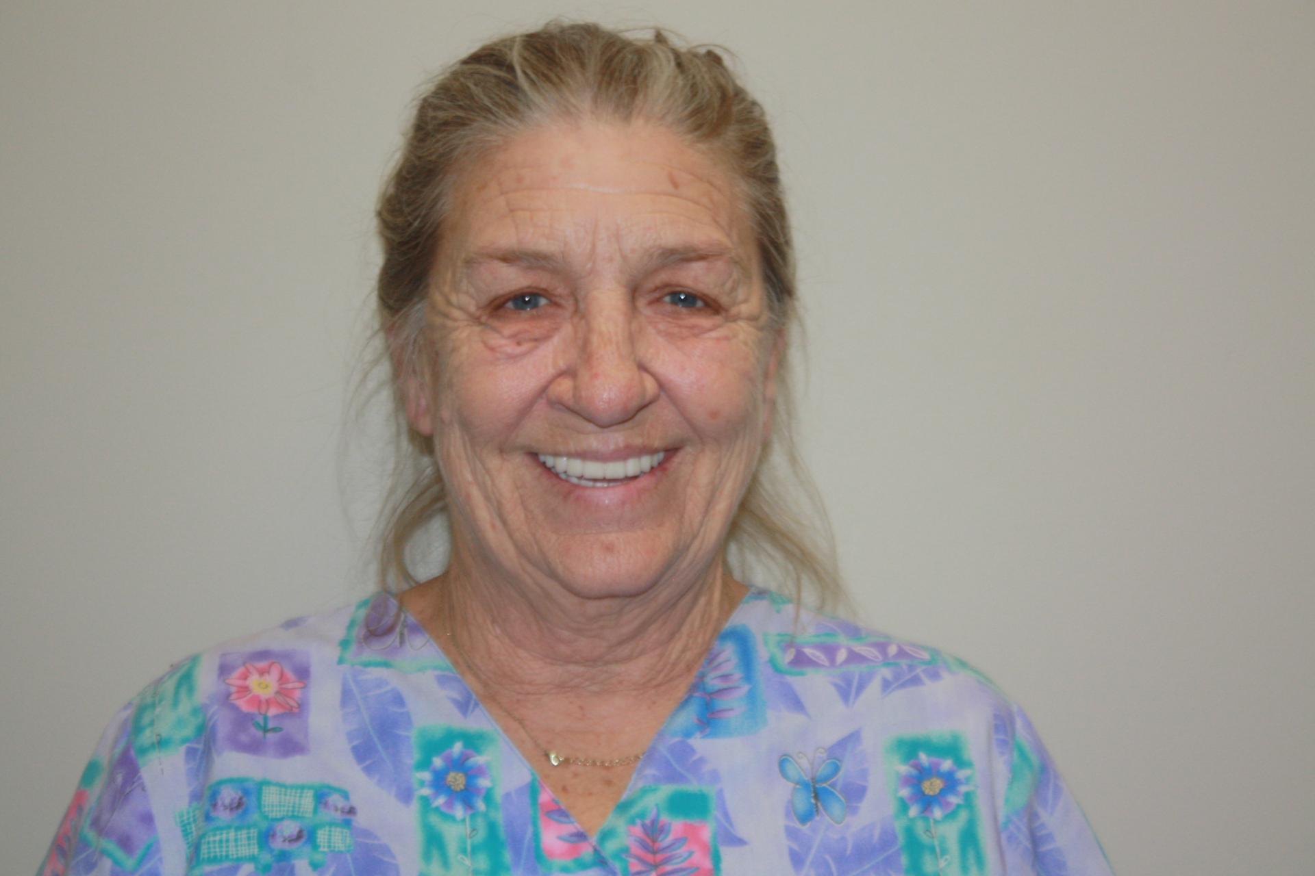 North County Cosmetic and Implant Dentistry smile makeover after — Vista, CA