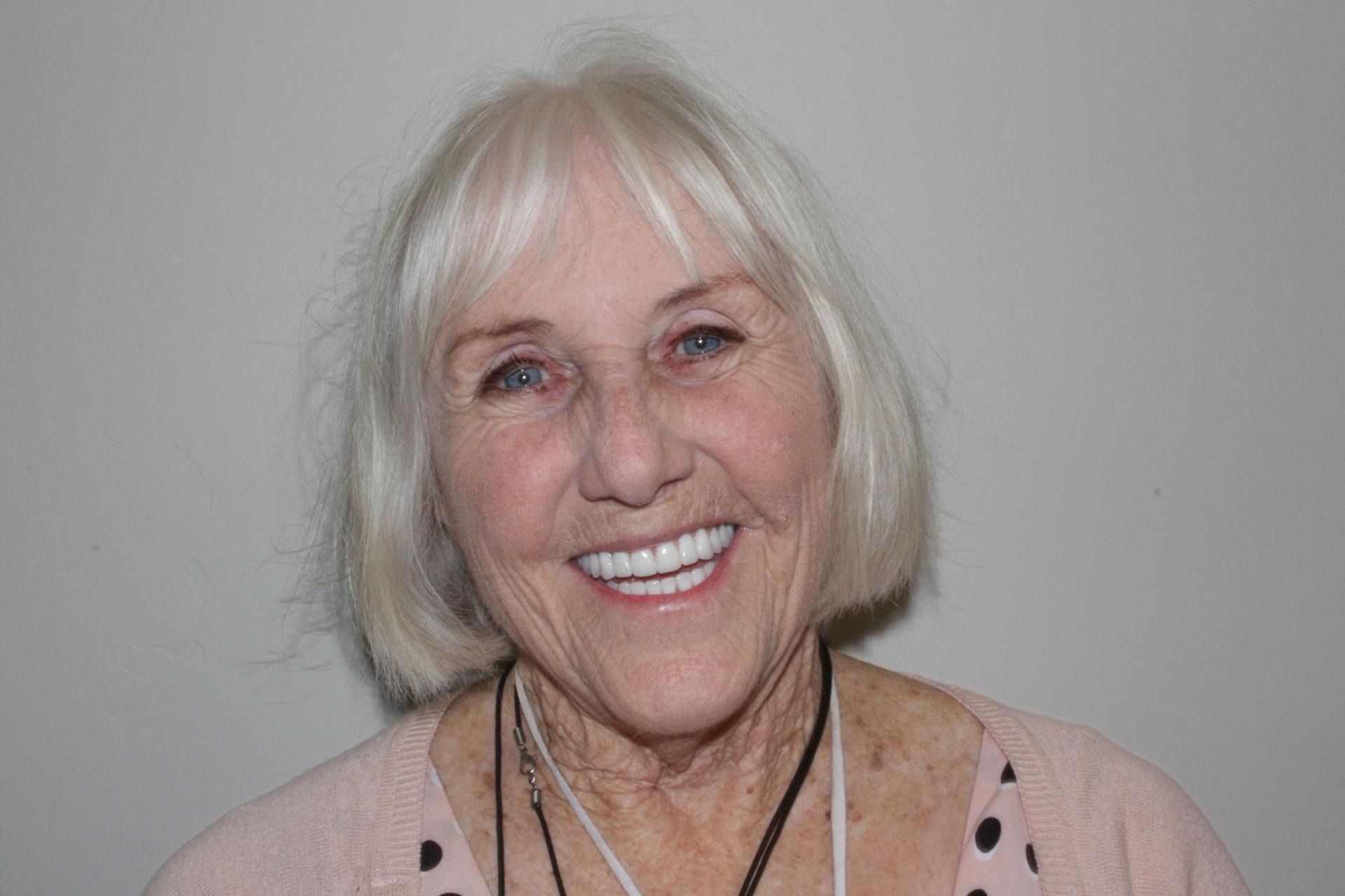 North County Cosmetic and Implant Dentistry smile makeover after — Vista, CA