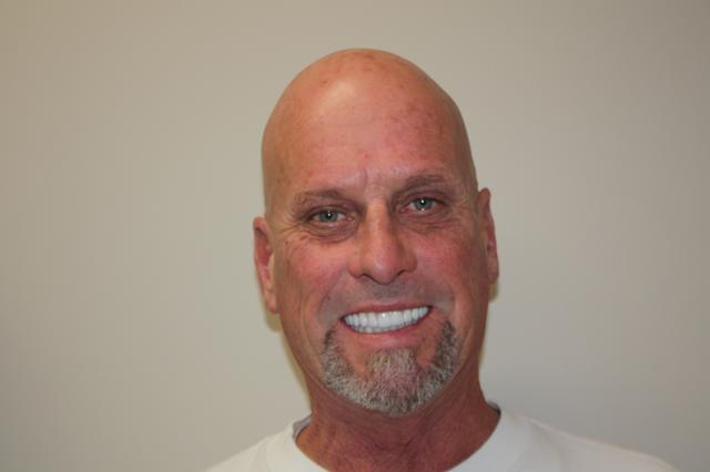 Smile Makeover after at North County Cosmetic and Implant Dentistry in Vista, CA