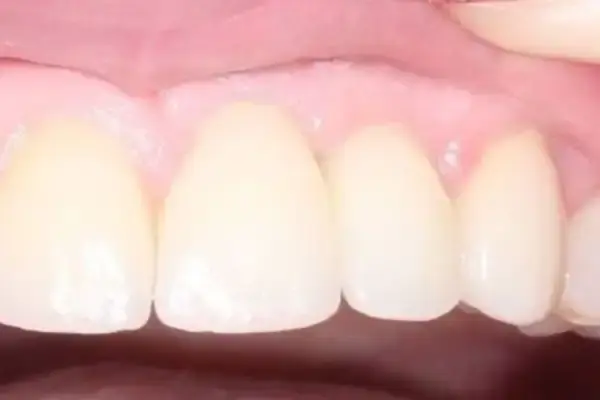 Dental Works dental implants after — Scottsdale, AZ
