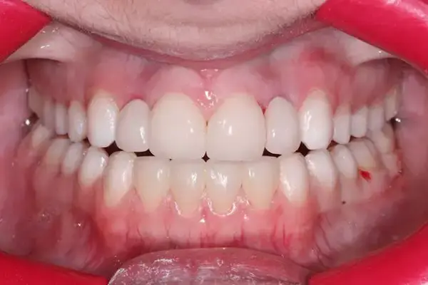 Dental Works dental implants after — Scottsdale, AZ