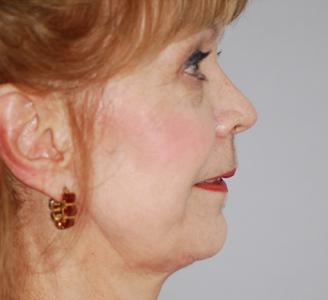 Michigan Facial Aesthetic Surgeons provider photo