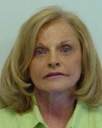 Barrington Plastic Surgery (Gregory M. Bazell, MD) eyelid lift after — South Barrington, IL