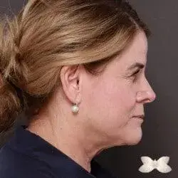 Utah Facial Plastics & UFP Hair Restoration provider photo