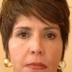 Utah Facial Plastics & UFP Hair Restoration facelift after — Draper, UT
