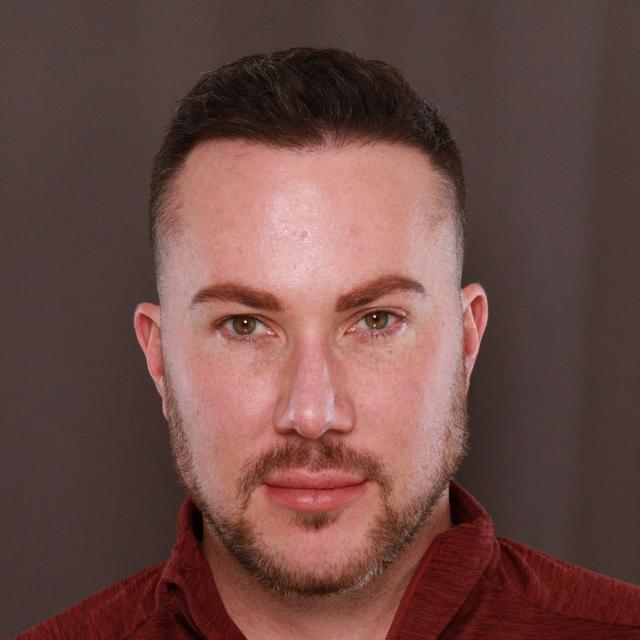Laser Skin Resurfacing after at Utah Facial Plastics & UFP Hair Restoration in Draper, UT