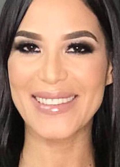 SkinTight MedSpa skin tightening result — New York, NY
