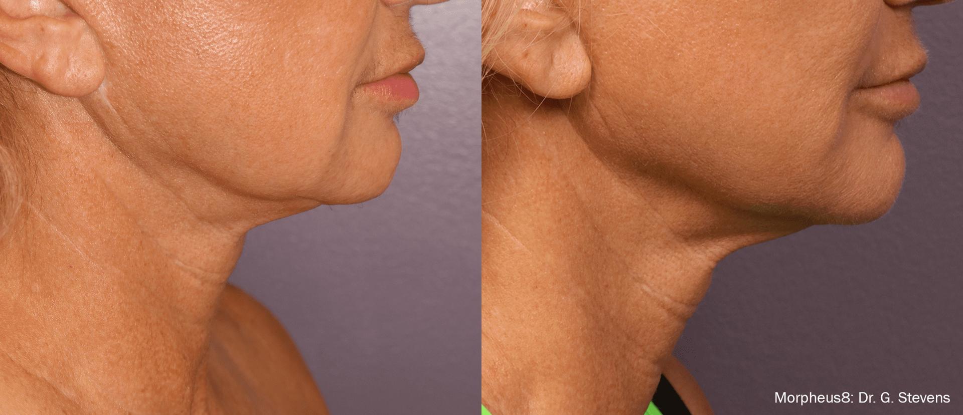 Jordan Valley Dermatology Center result — South Jordan, UT