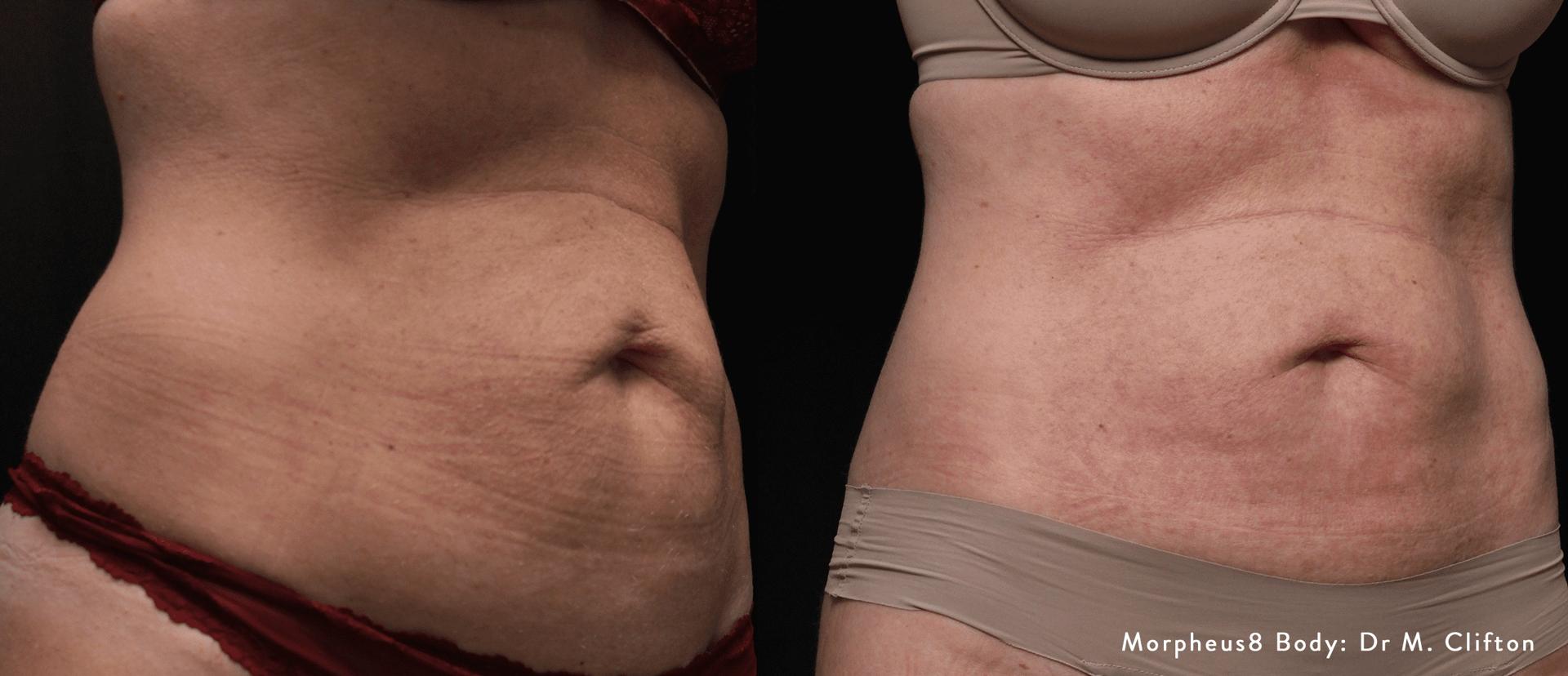 Jordan Valley Dermatology Center result — South Jordan, UT