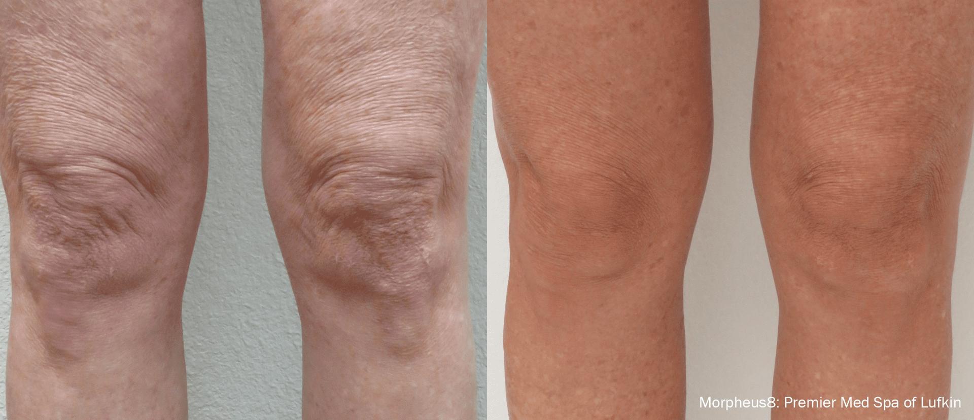 Jordan Valley Dermatology Center result — South Jordan, UT