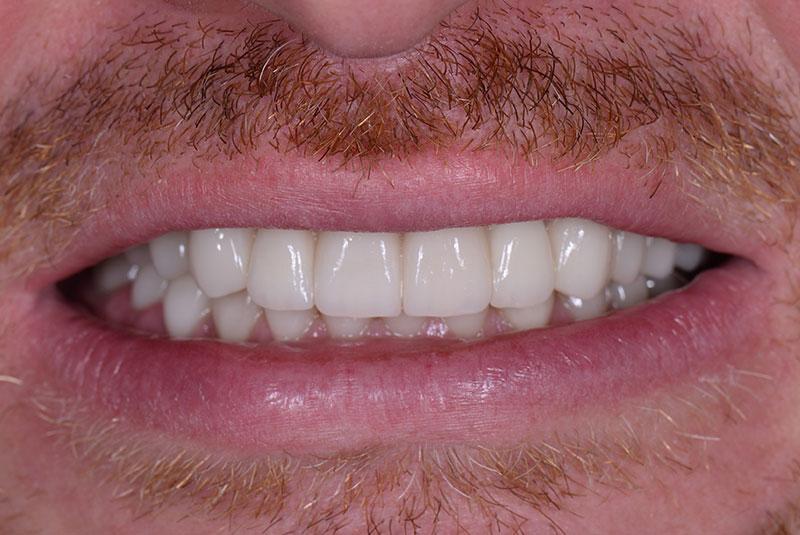 Facial Designs, P.A. after — Minnetonka, MN