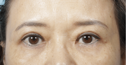 John Kim, MD, FACS result — Chicago, IL