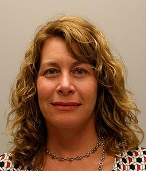 Hessler Plastic Surgery (Jill Hessler, MD) facelift after — Palo Alto, CA