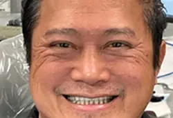 Coastal Dental Arts smile makeover after — San Diego, CA