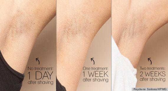 Aesthetic Center of Columbia result — Columbia, MD