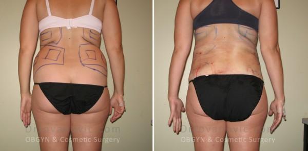 Dr. Jovanovic, OBGYN & Cosmetic Surgery result — New York, NY