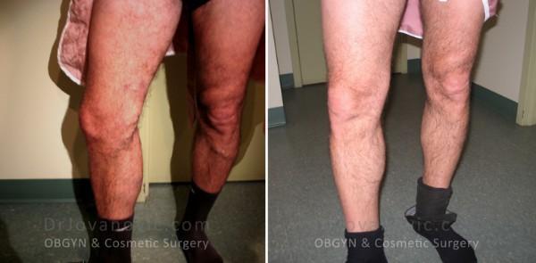 Dr. Jovanovic, OBGYN & Cosmetic Surgery result — New York, NY