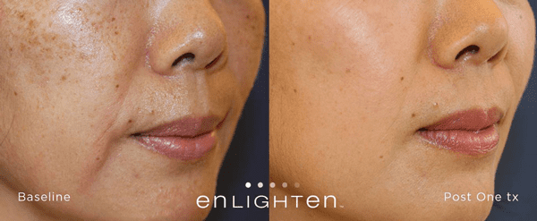 Dr. Jovanovic, OBGYN & Cosmetic Surgery result — New York, NY