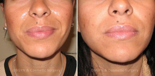 Dr. Jovanovic, OBGYN & Cosmetic Surgery result — New York, NY
