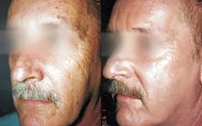 My Plastic Surgery Group result — Carmel, IN