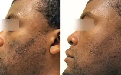 My Plastic Surgery Group result — Carmel, IN