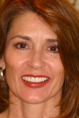 Almeida & Bell Dental veneers after — Denver, CO