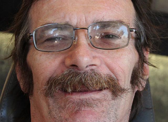 Smile Makeover before at Whiteridge Aesthetic Dentistry in Salt Lake City, UT