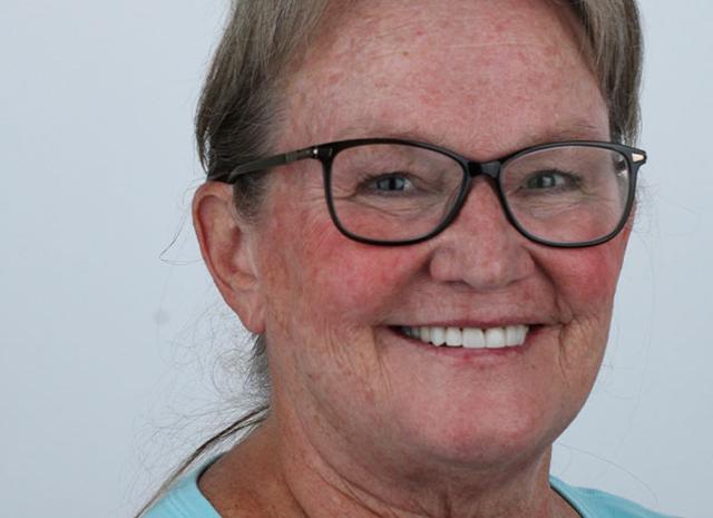 Smile Makeover after at Whiteridge Aesthetic Dentistry in Salt Lake City, UT