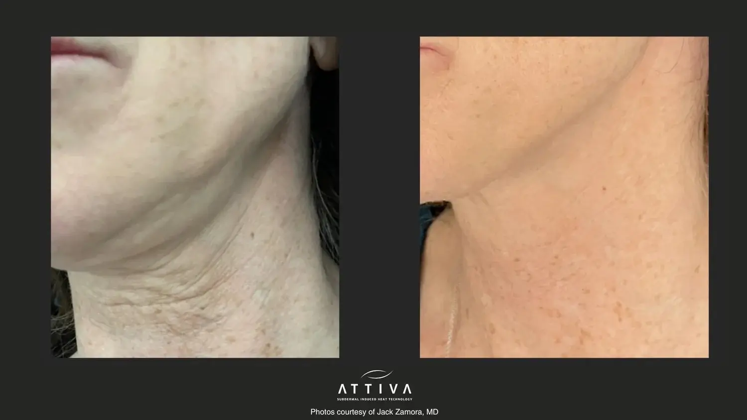 Aesthetic Skin & Laser Center result — Pittsburgh, PA