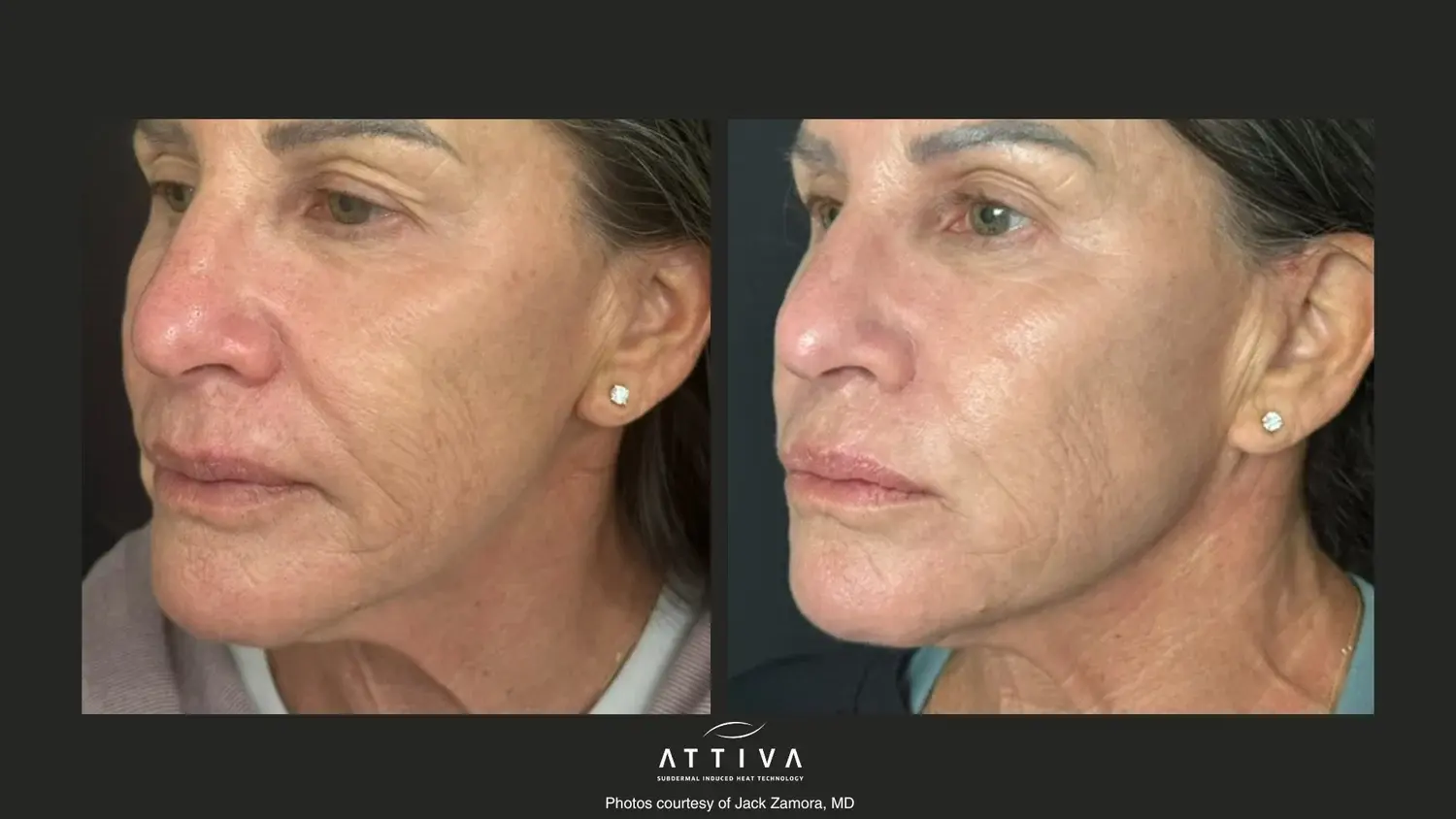 Aesthetic Skin & Laser Center result — Pittsburgh, PA