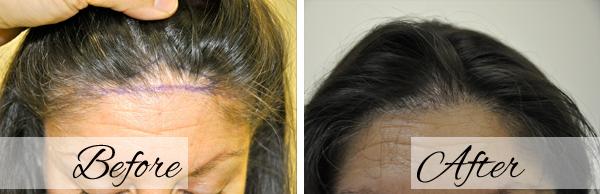 Dr.Riyaz Hassanali: Advanced Cosmetic Surgery Center result — Buffalo, NY
