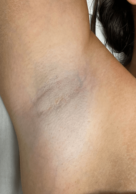 ZONA MED SPA after — Scottsdale, AZ
