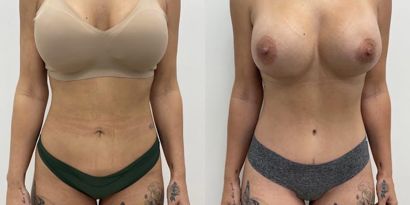 Dr. Adam J. Oppenheimer, MD result — Orlando, FL