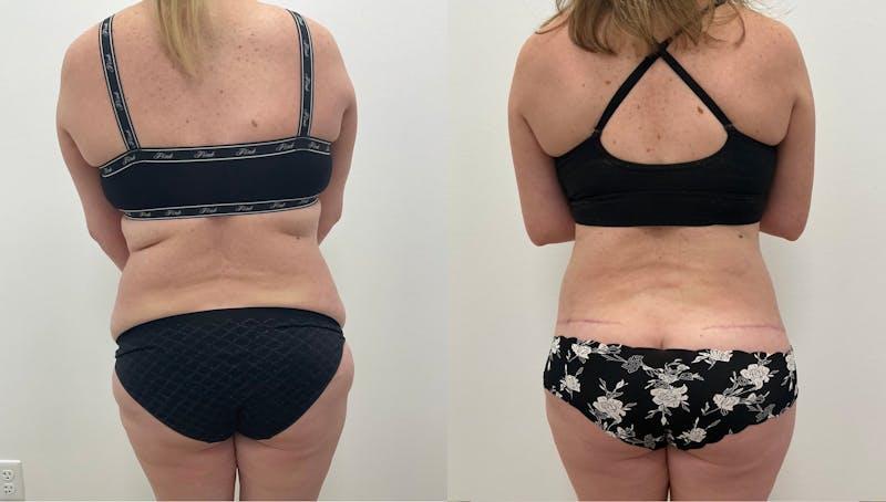 Dr. Adam J. Oppenheimer, MD result — Orlando, FL