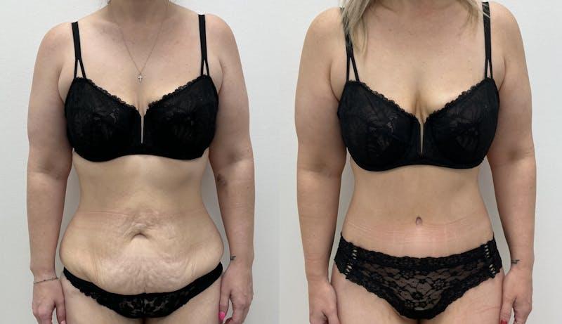Dr. Adam J. Oppenheimer, MD result — Orlando, FL
