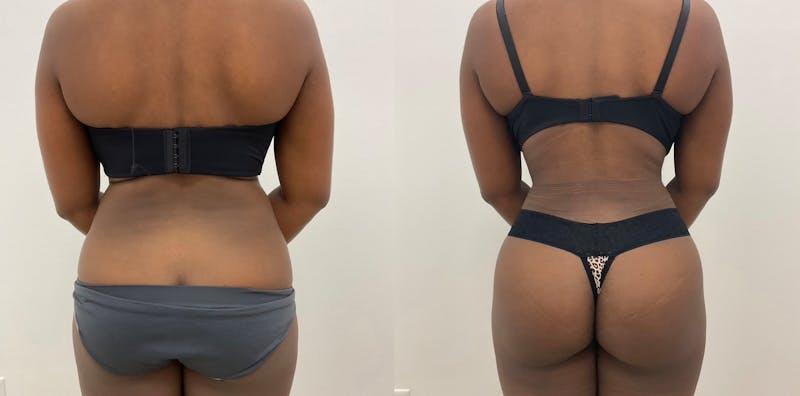 Dr. Adam J. Oppenheimer, MD result — Orlando, FL