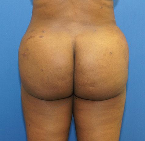Neal Goldberg, MD bbl after — Scarsdale, NY