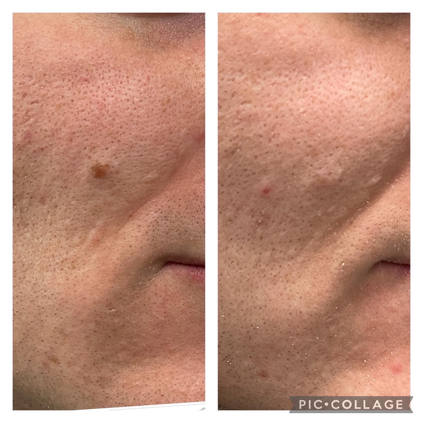 Skin and Face Phoenix result — Phoenix, AZ