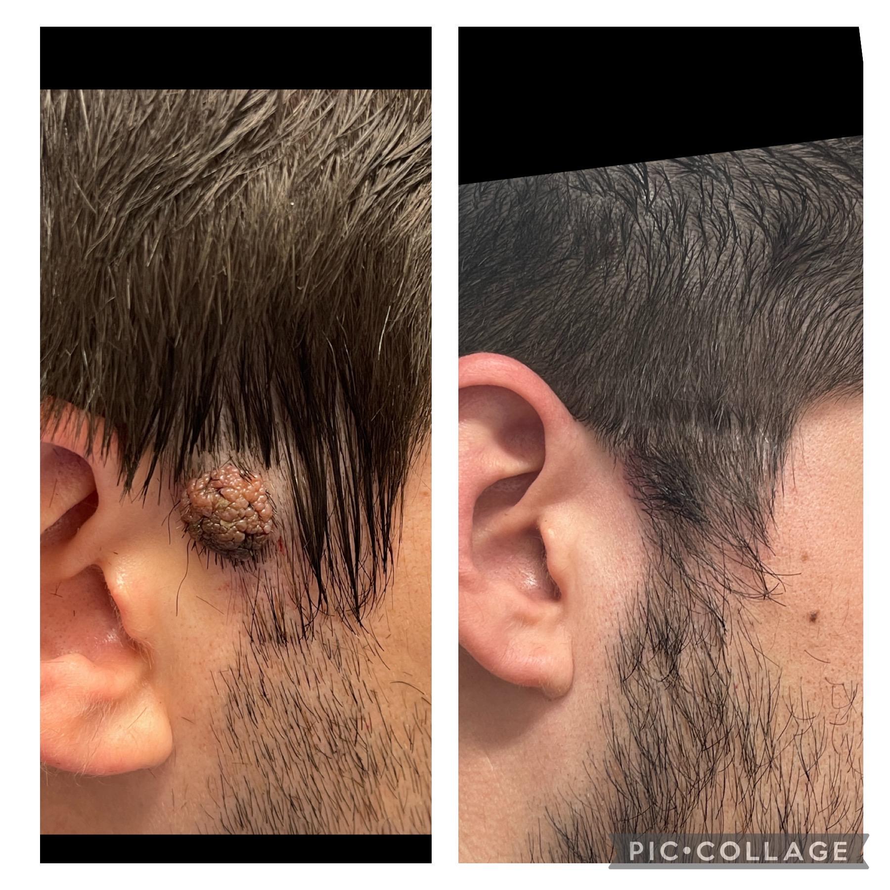 Skin and Face Phoenix result — Phoenix, AZ