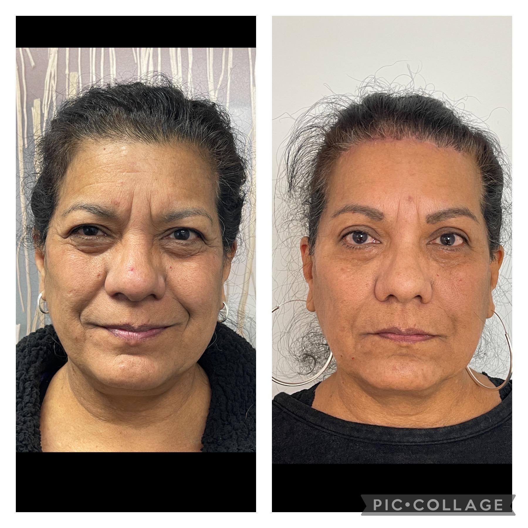 Skin and Face Phoenix result — Phoenix, AZ