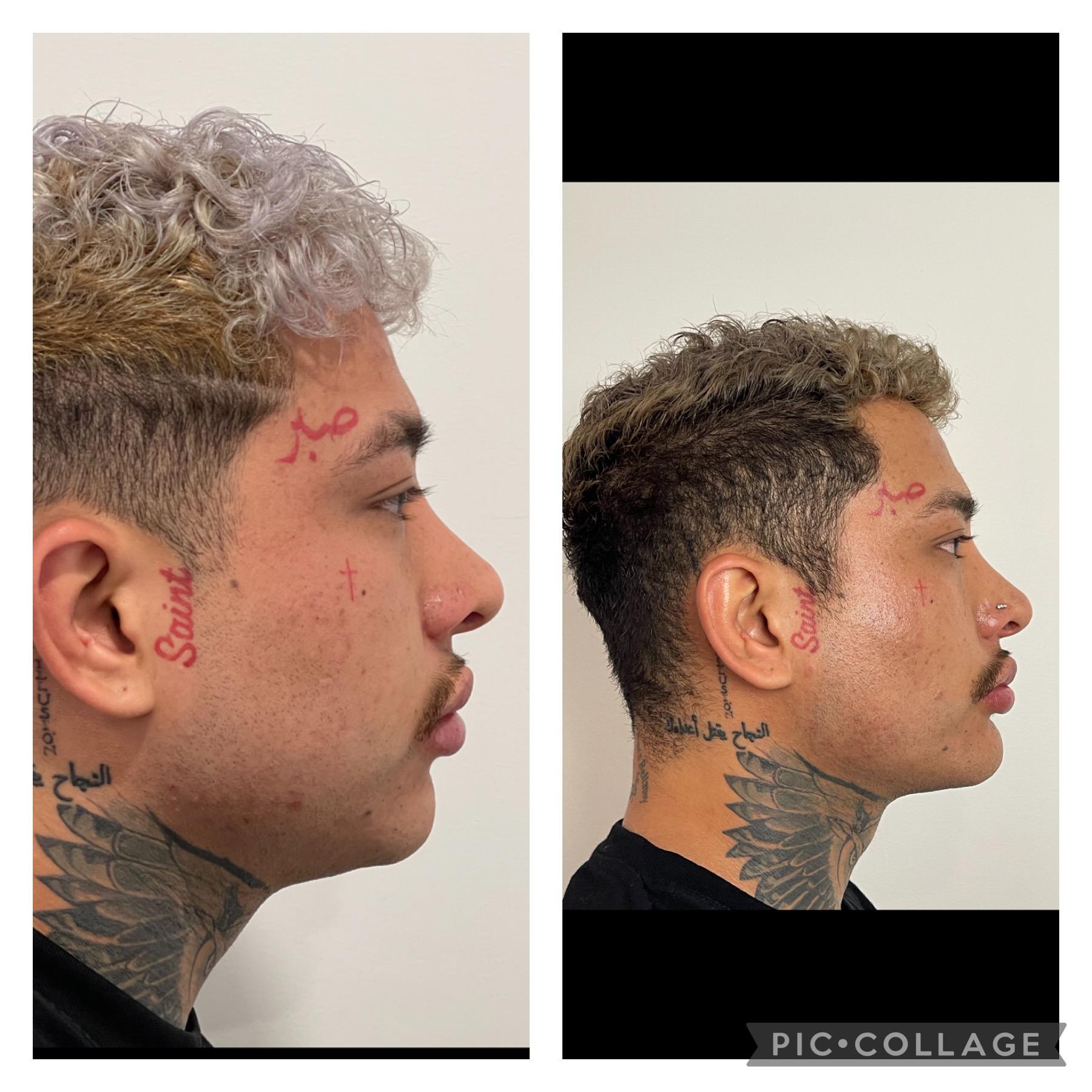 Skin and Face Phoenix result — Phoenix, AZ