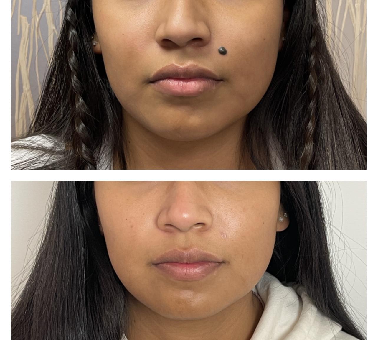 Skin and Face Phoenix result — Phoenix, AZ