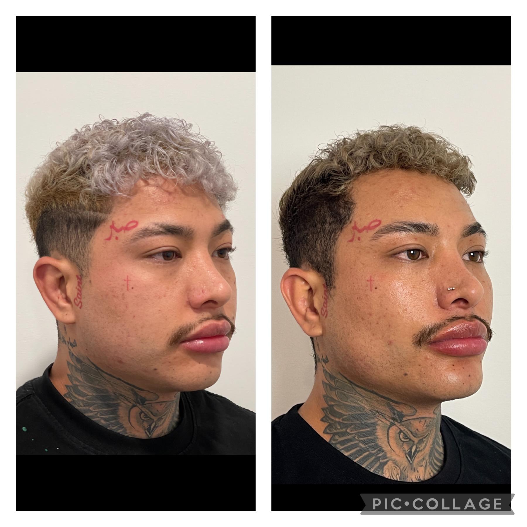 Skin and Face Phoenix result — Phoenix, AZ