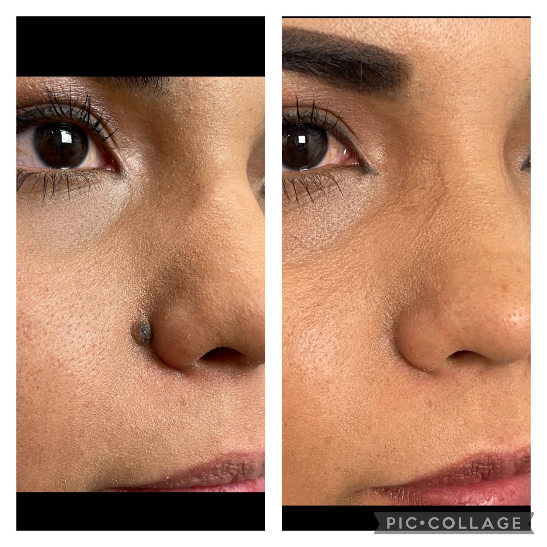 Skin and Face Phoenix result — Phoenix, AZ