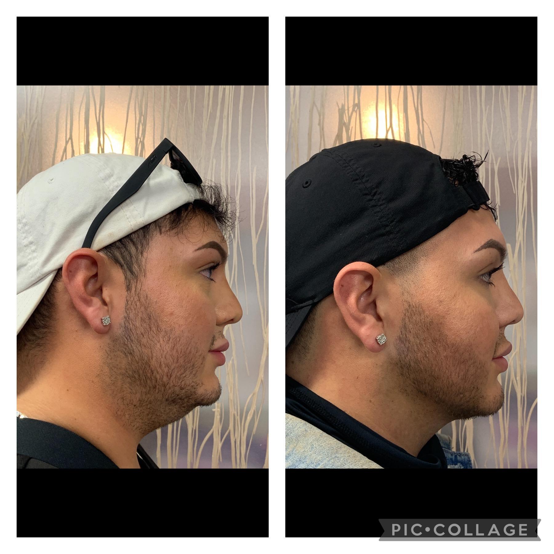 Skin and Face Phoenix result — Phoenix, AZ