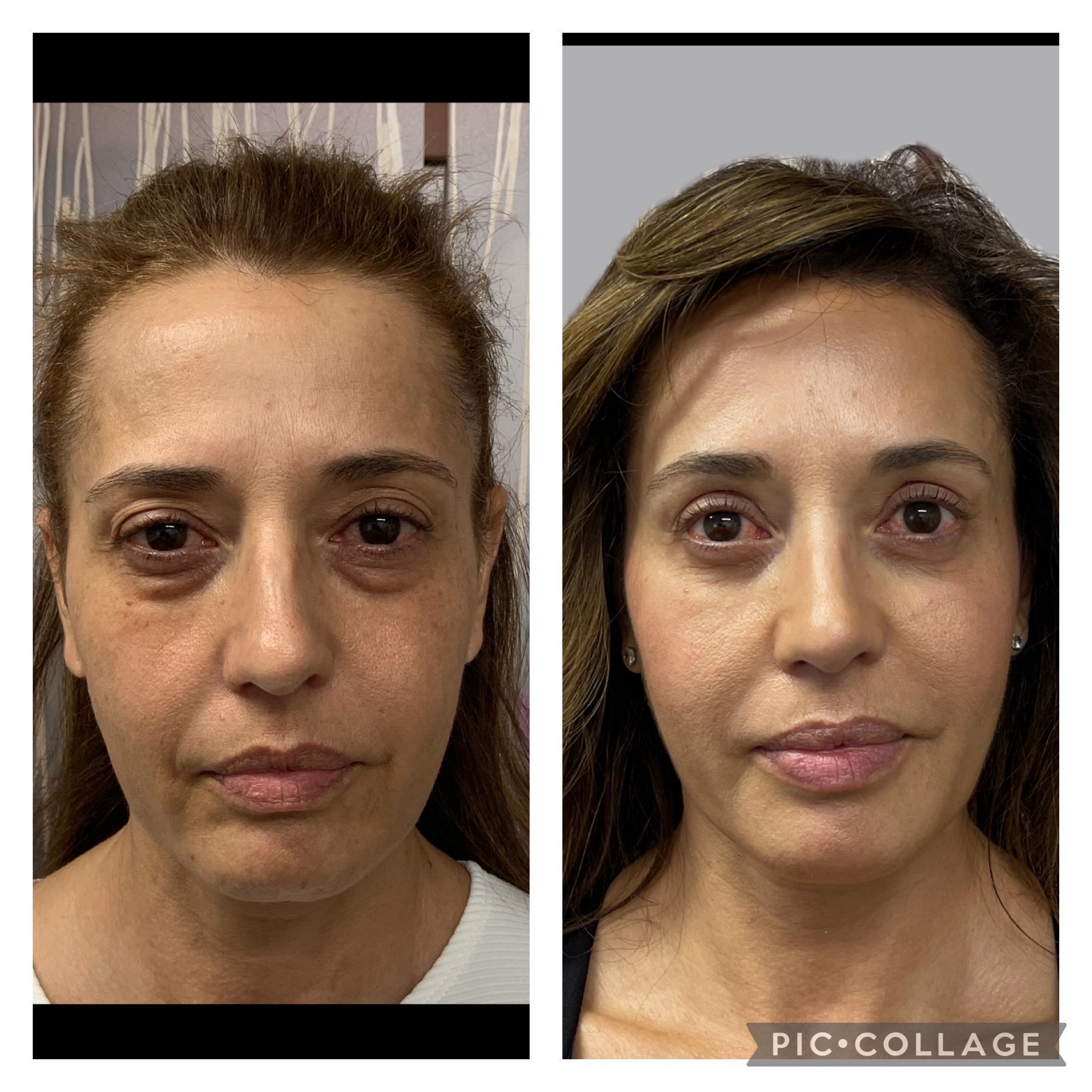 Skin and Face Phoenix result — Phoenix, AZ