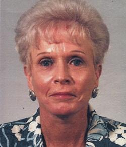 Mazza Plastic Surgery facelift after — Fort Myers, FL