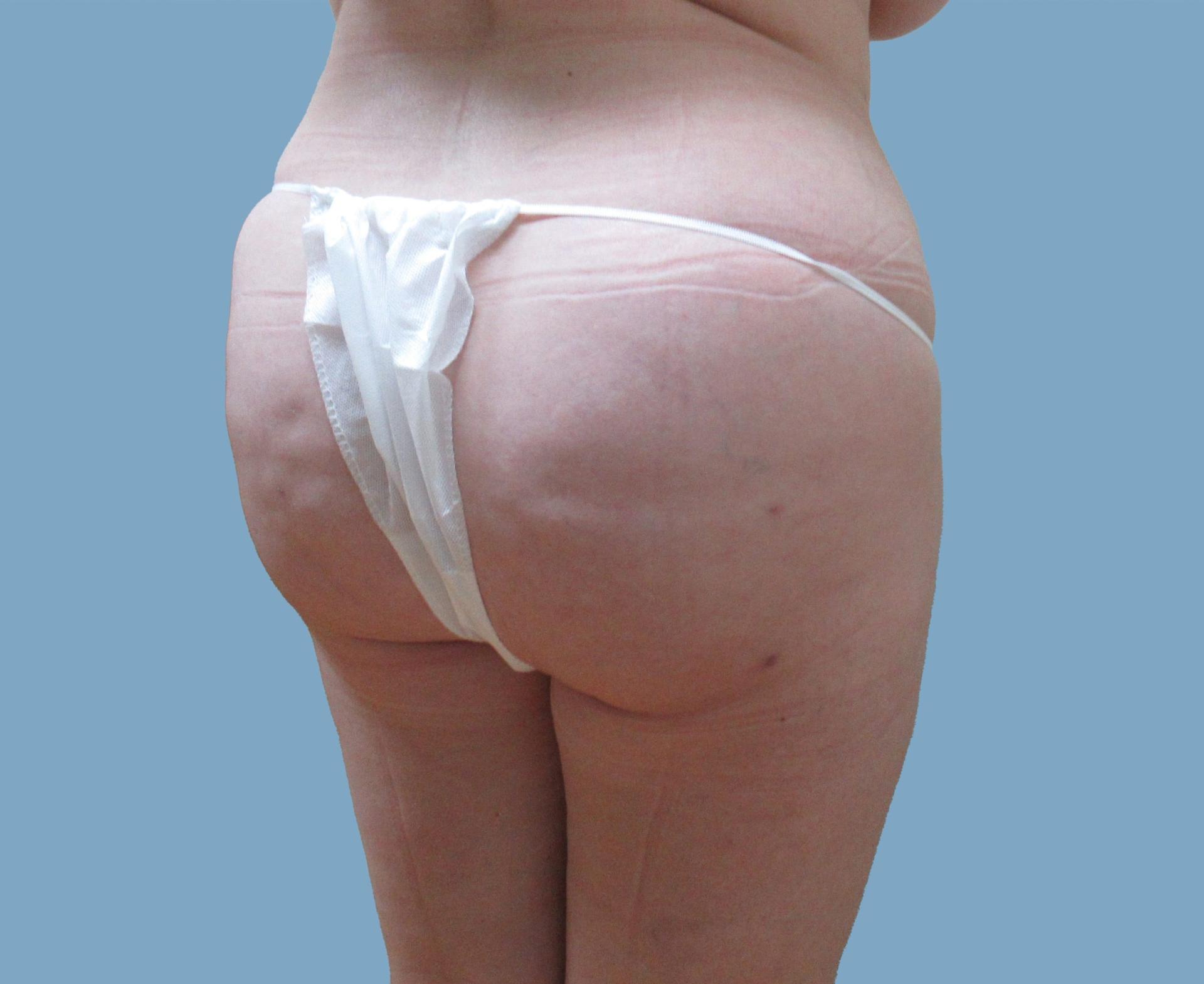 Lyle M. Back, MD bbl after — Cherry Hill Township, NJ