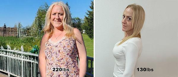 Vigam Medical Spa and Laser result — Hillsboro, OR
