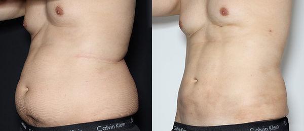Vigam Medical Spa and Laser result — Hillsboro, OR